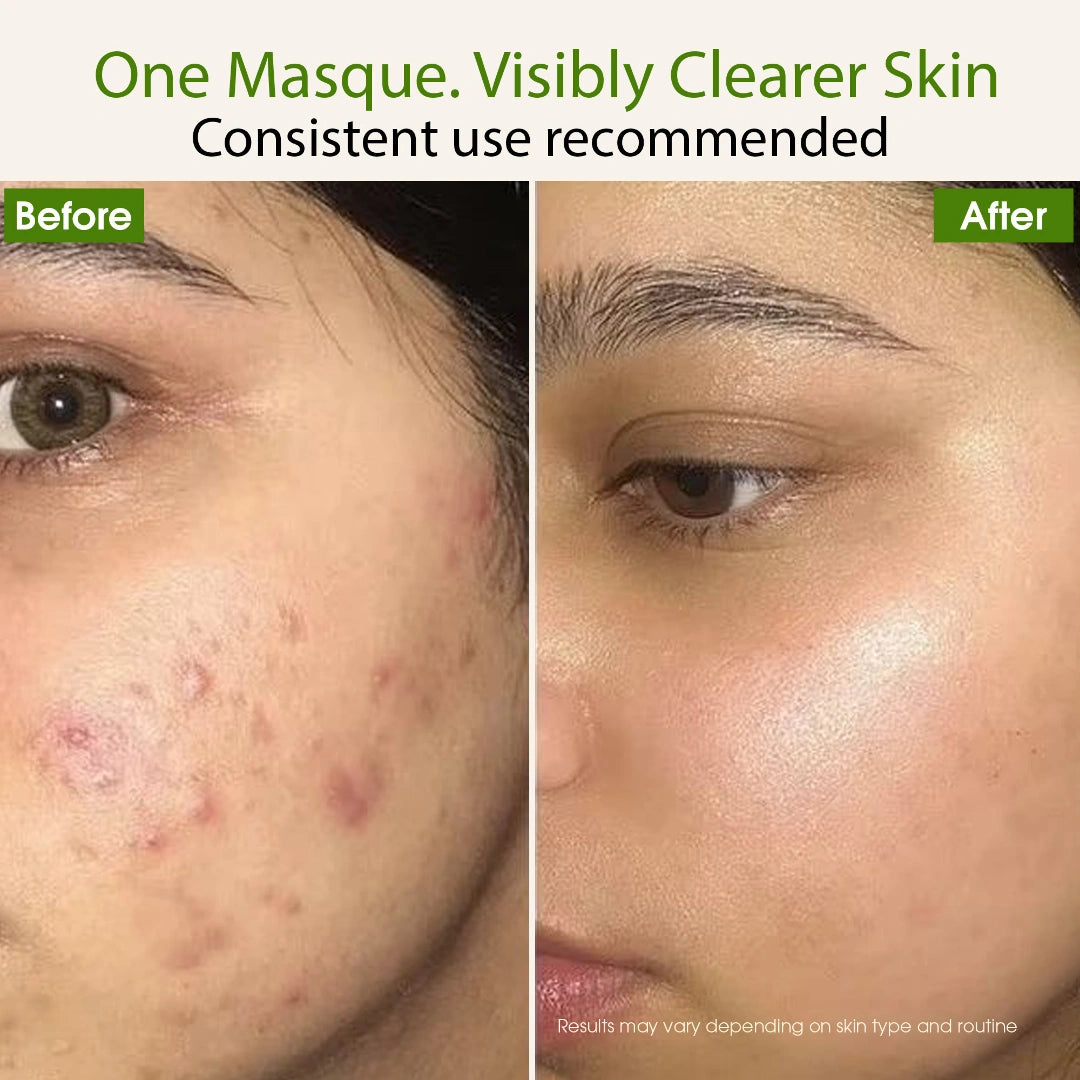 Supergreen Reset Masque