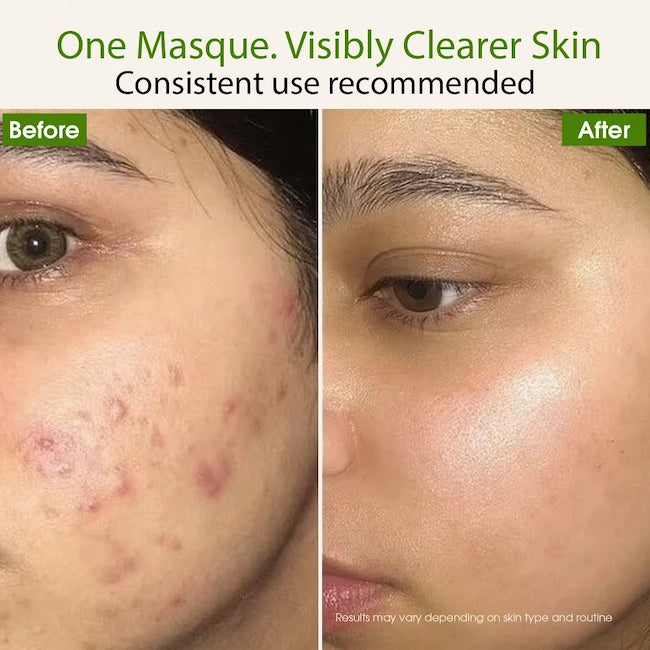 Supergreen Reset Masque