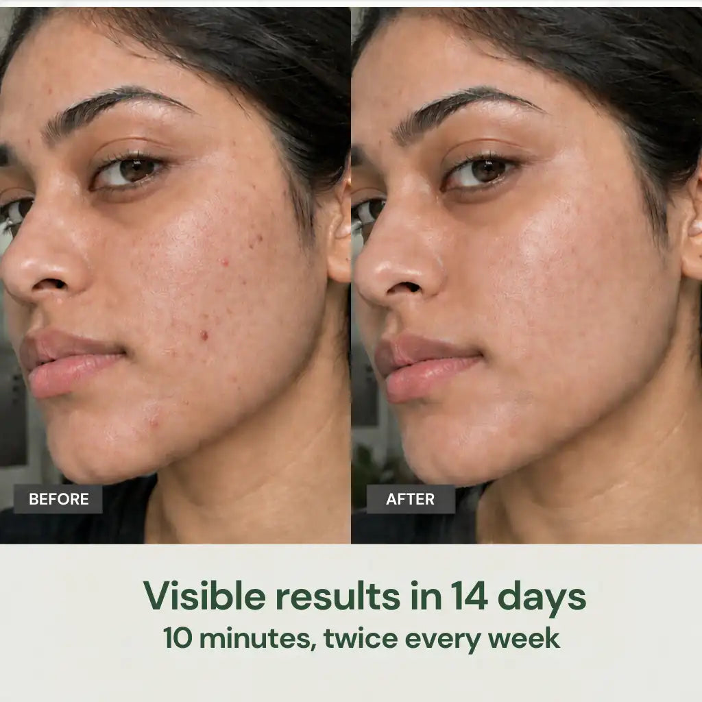 Supergreen Reset Masque